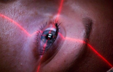 Bien comprendre la chirurgie des yeux au laser