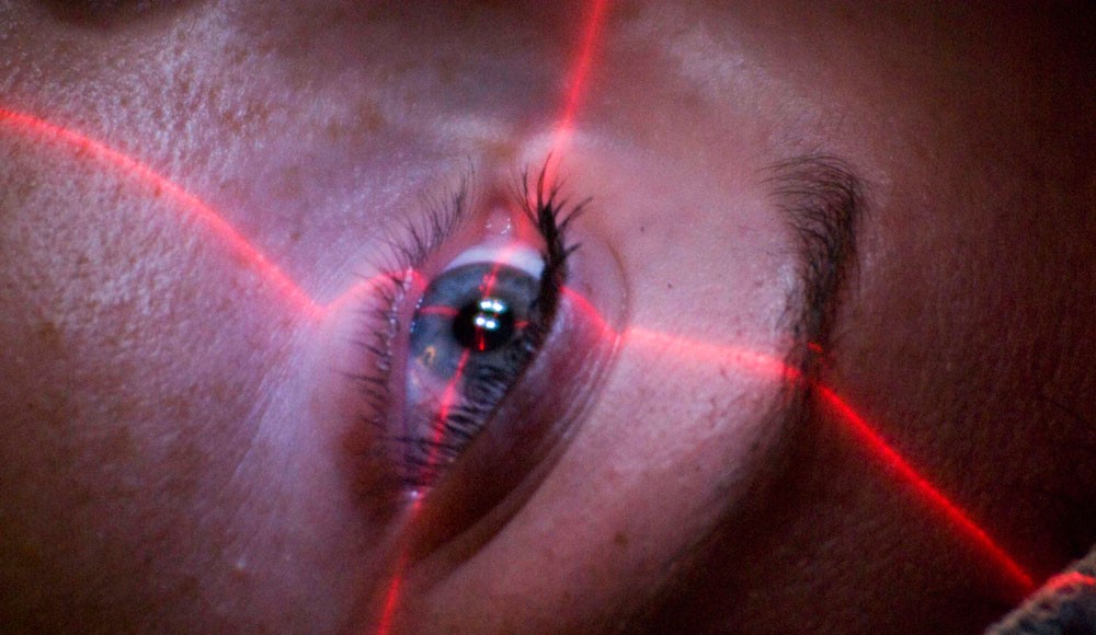 Bien comprendre la chirurgie des yeux au laser